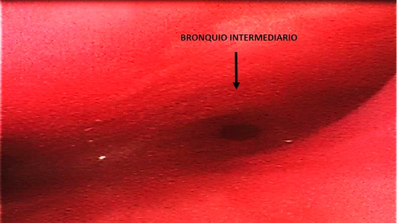 figura 2