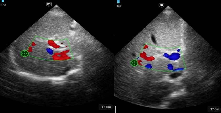 Figura 2