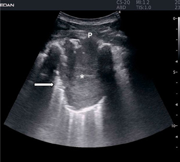 fig1